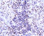 Histone H2A.Z Antibody in Immunohistochemistry (Paraffin) (IHC (P))