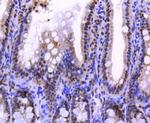 Histone H2A.Z Antibody in Immunohistochemistry (Paraffin) (IHC (P))