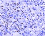 Histone H2A.Z Antibody in Immunohistochemistry (Paraffin) (IHC (P))