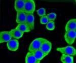 HK1 Antibody in Immunocytochemistry (ICC/IF)