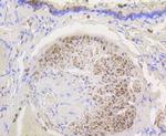 HK1 Antibody in Immunohistochemistry (Paraffin) (IHC (P))