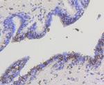 HK1 Antibody in Immunohistochemistry (Paraffin) (IHC (P))