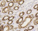 HK1 Antibody in Immunohistochemistry (Paraffin) (IHC (P))