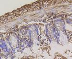 HK1 Antibody in Immunohistochemistry (Paraffin) (IHC (P))