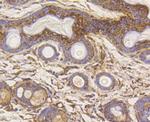 HK1 Antibody in Immunohistochemistry (Paraffin) (IHC (P))