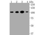 HK1 Antibody in Western Blot (WB)