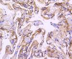 ICAM-1 Antibody in Immunohistochemistry (Paraffin) (IHC (P))