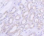 AKT1 Antibody in Immunohistochemistry (Paraffin) (IHC (P))