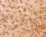 AKT1 Antibody in Immunohistochemistry (Paraffin) (IHC (P))