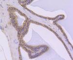 AKT1 Antibody in Immunohistochemistry (Paraffin) (IHC (P))