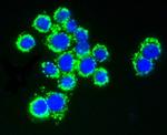 AKT Pan Antibody in Immunocytochemistry (ICC/IF)