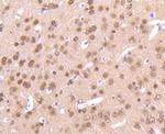 AKT Pan Antibody in Immunohistochemistry (Paraffin) (IHC (P))