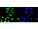 PIM1 Antibody in Immunocytochemistry (ICC/IF)