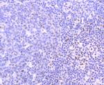 PIM1 Antibody in Immunohistochemistry (Paraffin) (IHC (P))