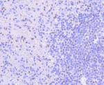 PIM1 Antibody in Immunohistochemistry (Paraffin) (IHC (P))