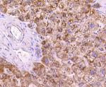 SGK1 Antibody in Immunohistochemistry (Paraffin) (IHC (P))