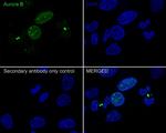 Aurora B Antibody in Immunocytochemistry (ICC/IF)