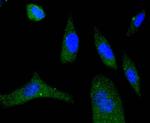 Phospho-eIF4E (Ser209) Antibody in Immunocytochemistry (ICC/IF)