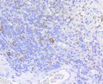 Phospho-eIF4E (Ser209) Antibody in Immunohistochemistry (Paraffin) (IHC (P))