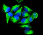 Vimentin Antibody in Immunocytochemistry (ICC/IF)