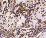 Vimentin Antibody in Immunohistochemistry (Paraffin) (IHC (P))