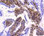 Vimentin Antibody in Immunohistochemistry (Paraffin) (IHC (P))