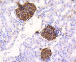 Vimentin Antibody in Immunohistochemistry (Paraffin) (IHC (P))