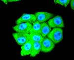 eIF5A Antibody in Immunocytochemistry (ICC/IF)