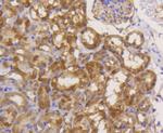 eIF5A Antibody in Immunohistochemistry (Paraffin) (IHC (P))