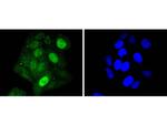 STAT5 alpha Antibody in Immunocytochemistry (ICC/IF)