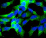 SHH Antibody in Immunocytochemistry (ICC/IF)