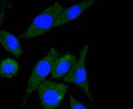 ILK Antibody in Immunocytochemistry (ICC/IF)