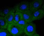 Protein APC Antibody in Immunocytochemistry (ICC/IF)