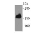 Protein APC Antibody in Western Blot (WB)