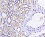 PKR Antibody in Immunohistochemistry (Paraffin) (IHC (P))