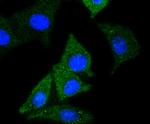 NSE Antibody in Immunocytochemistry (ICC/IF)