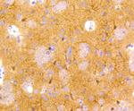 NSE Antibody in Immunohistochemistry (Paraffin) (IHC (P))