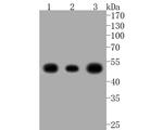 NSE Antibody in Western Blot (WB)