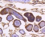 IKK alpha Antibody in Immunohistochemistry (Paraffin) (IHC (P))