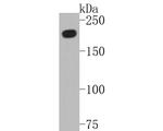 BRG1 Antibody in Western Blot (WB)