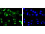 CDK4 Antibody in Immunocytochemistry (ICC/IF)