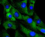 CDK4 Antibody in Immunocytochemistry (ICC/IF)