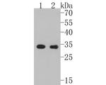 CDK4 Antibody in Western Blot (WB)