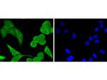 STAT1 Antibody in Immunocytochemistry (ICC/IF)