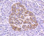 TRAF2 Antibody in Immunocytochemistry (ICC/IF)