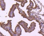 TRAF2 Antibody in Immunocytochemistry (ICC/IF)