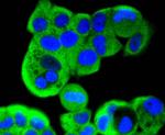 MEK2 Antibody in Immunocytochemistry (ICC/IF)