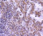 MEK2 Antibody in Immunohistochemistry (Paraffin) (IHC (P))