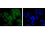 PAX5 Antibody in Immunocytochemistry (ICC/IF)