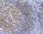 PAX5 Antibody in Immunohistochemistry (Paraffin) (IHC (P))